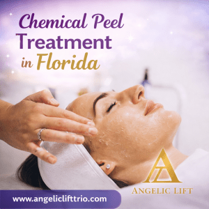 Chemical Peel Treatment in Florida
