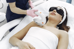 IPL laser treatment