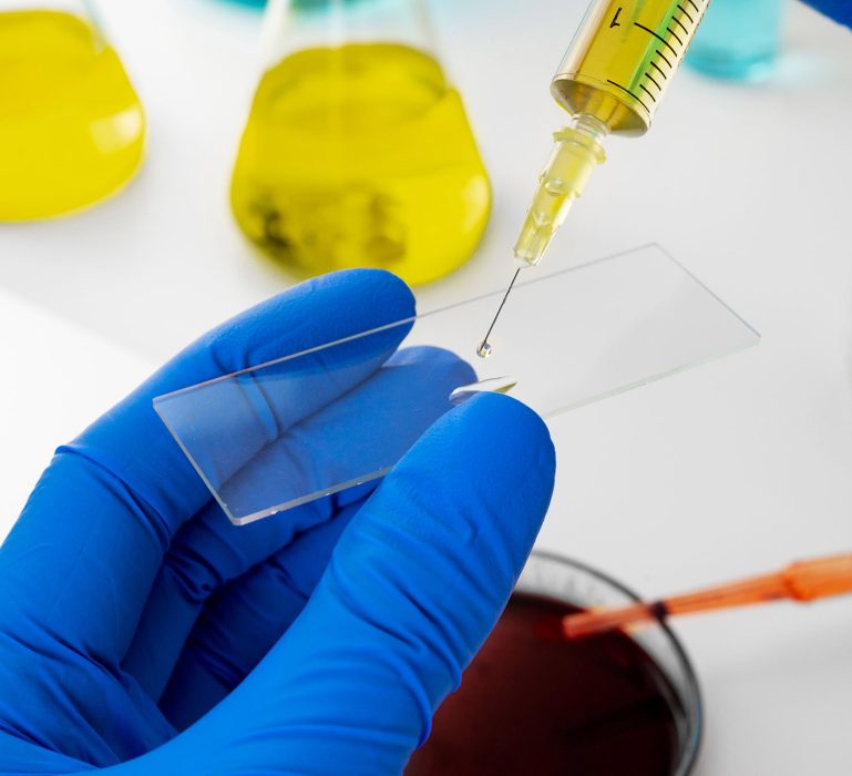 Genetic-Mutation-Testing-angelic-lift Genetic-Mutation-Testing-angelic-lift
