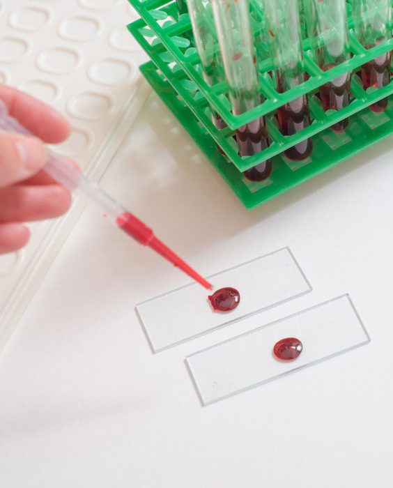 Scientist working with blood sample in laboratory