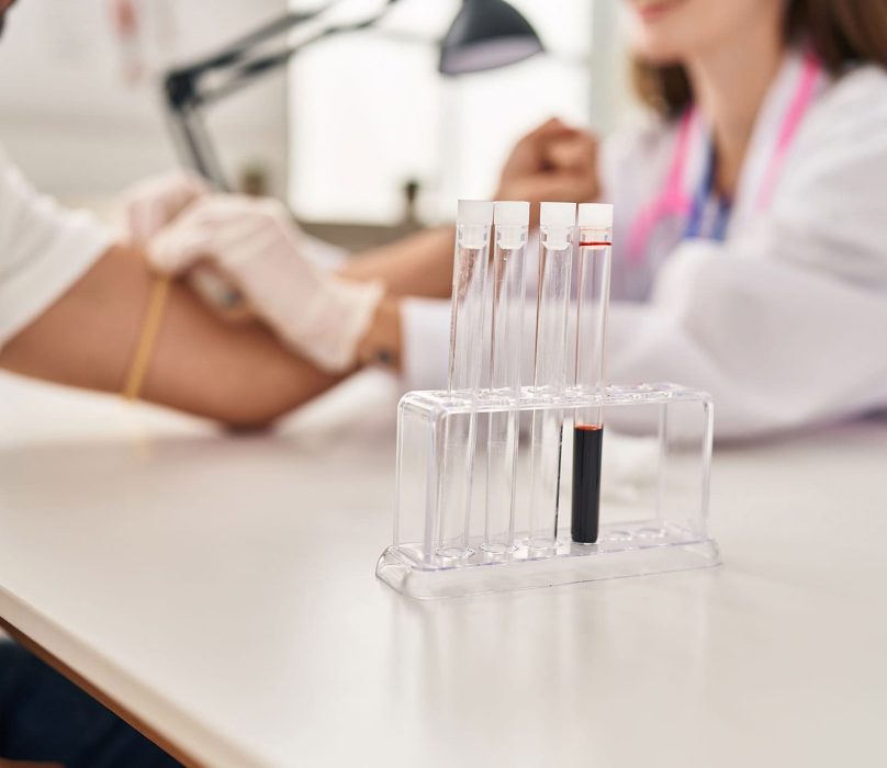 Pharmacogenetic-Testing-angelic