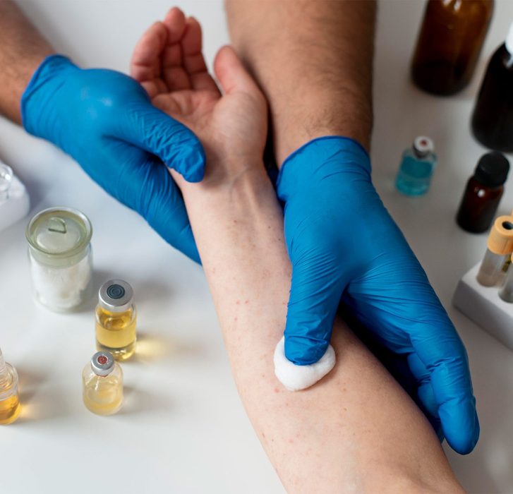 food-allergy-angelic