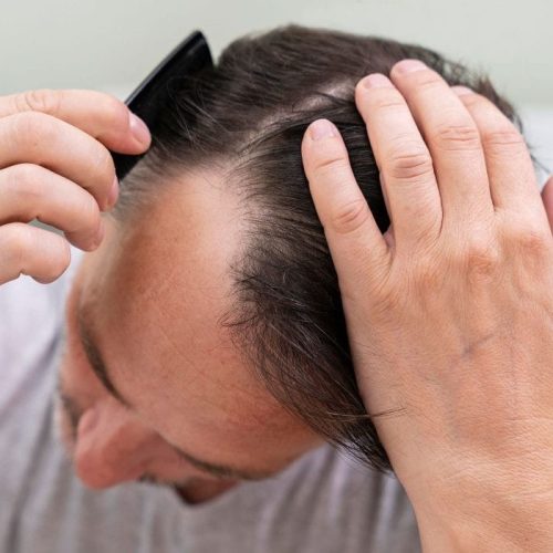 hair loss consultation services fl