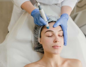 microneedling treatment Port Orange fl